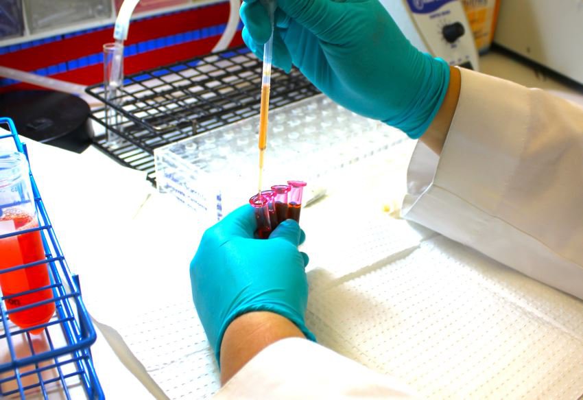 1655006740 Xet nghiem tien man cam HLA antibody screening